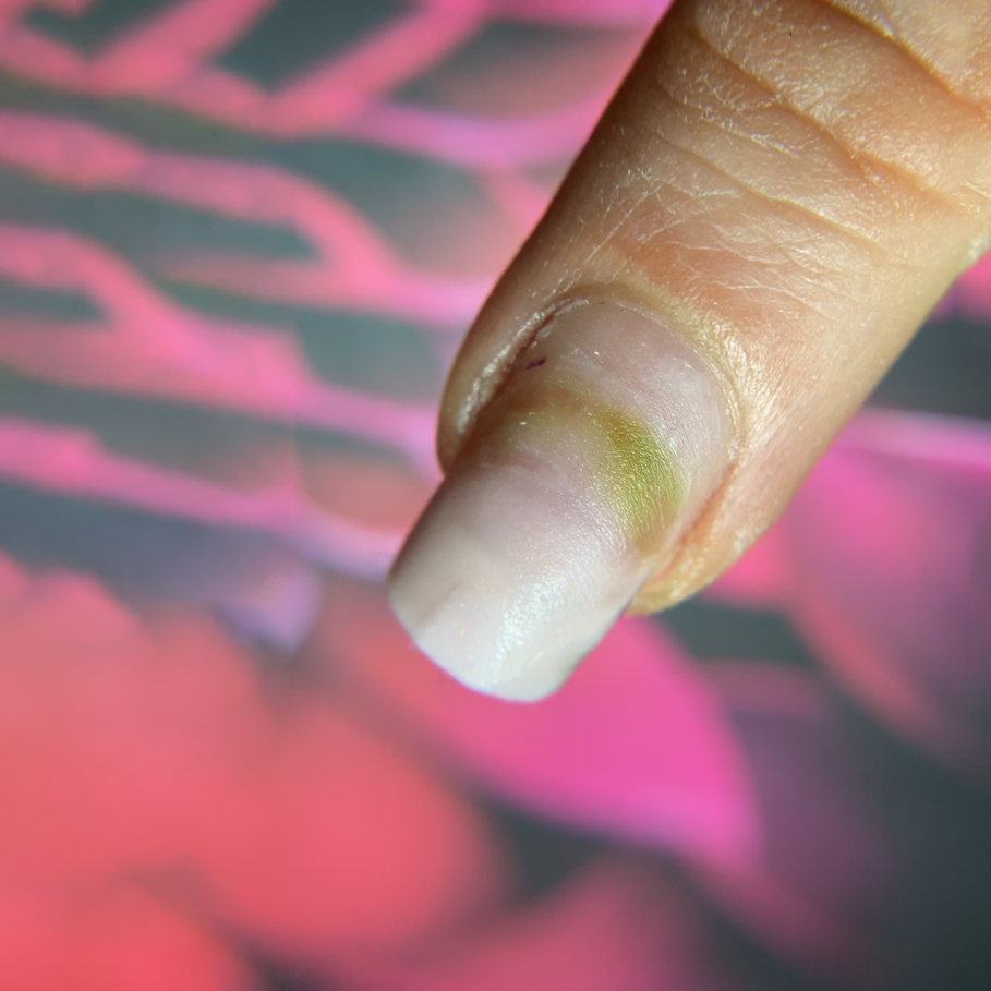 Bakteria Pseudomonas