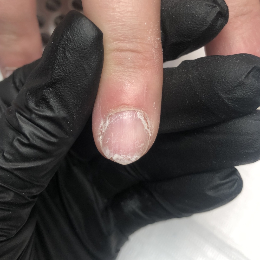 Nabłonek paznokciowy