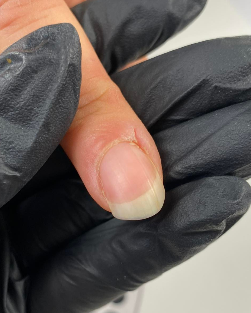 Naturalny paznokieć