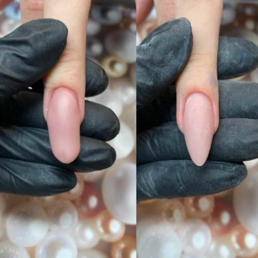 Metamorfoza migdała, piłowanie paznokcia – efekt przed i po