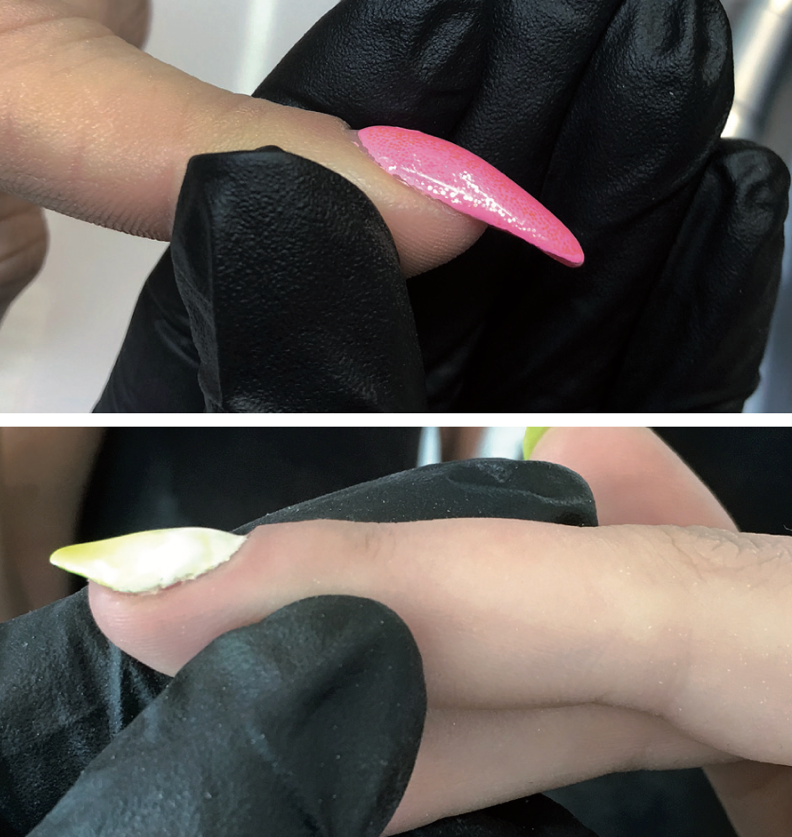 Przykłady nieprawidłowo zbudowanych łuków