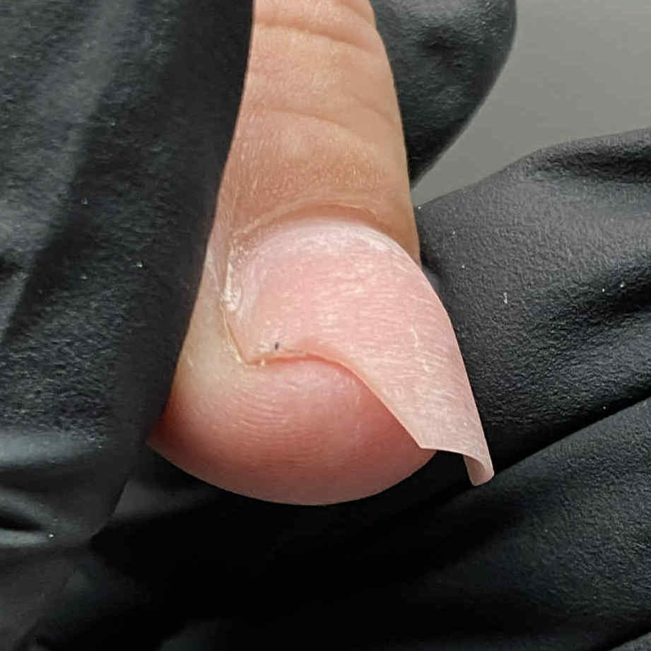 Złamany paznokieć żelowy