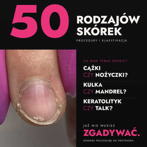 50 rodzajów skórek – klasyfikacja i procedury zabiegowe